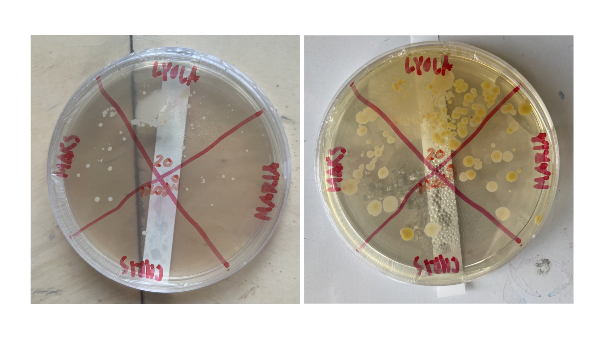 EditedBacteriaExercisePlate2